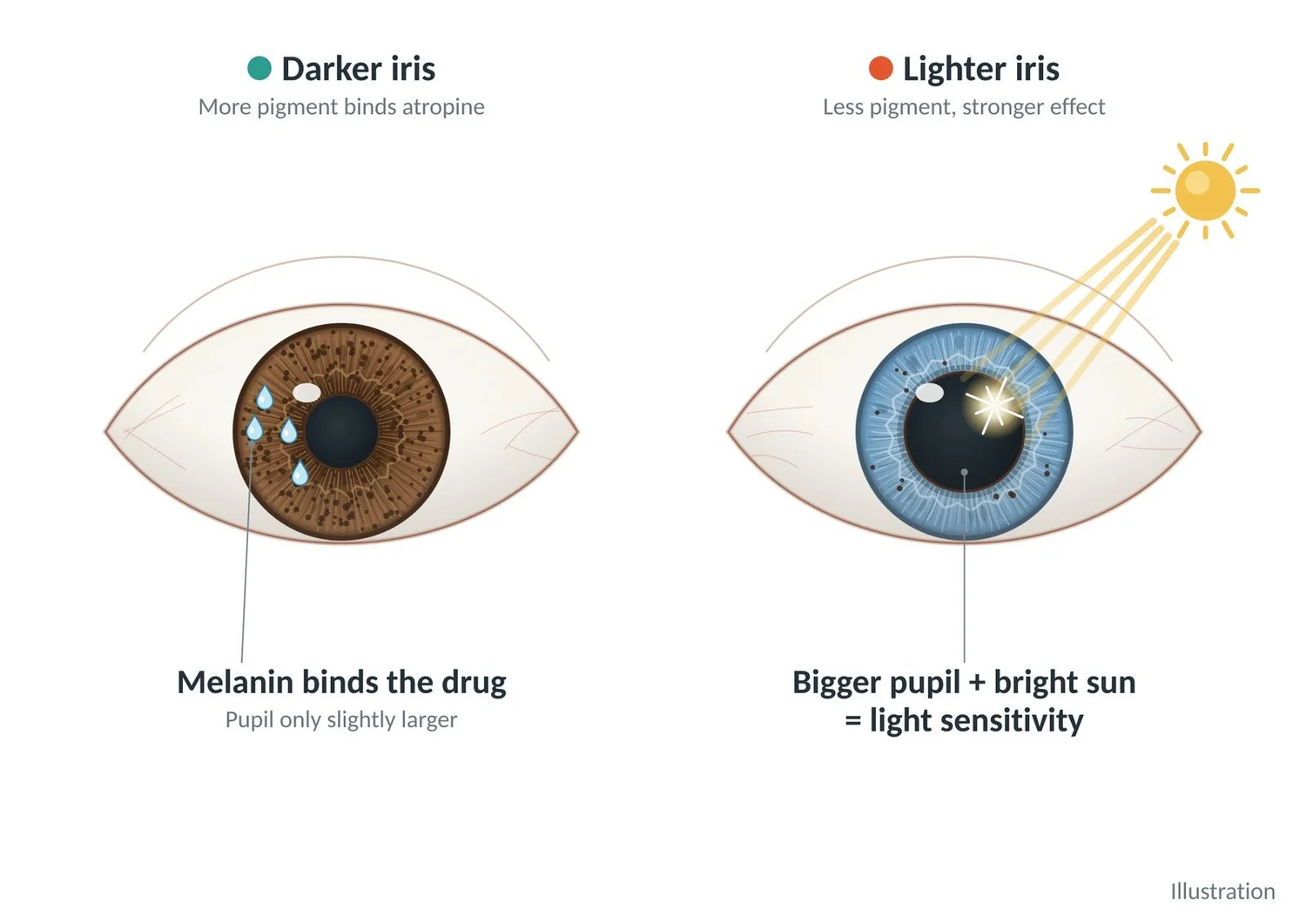Darker irises bind more atropine; lighter irises hold less, so the pupil dilates more and bright sun causes more light sensitivity.