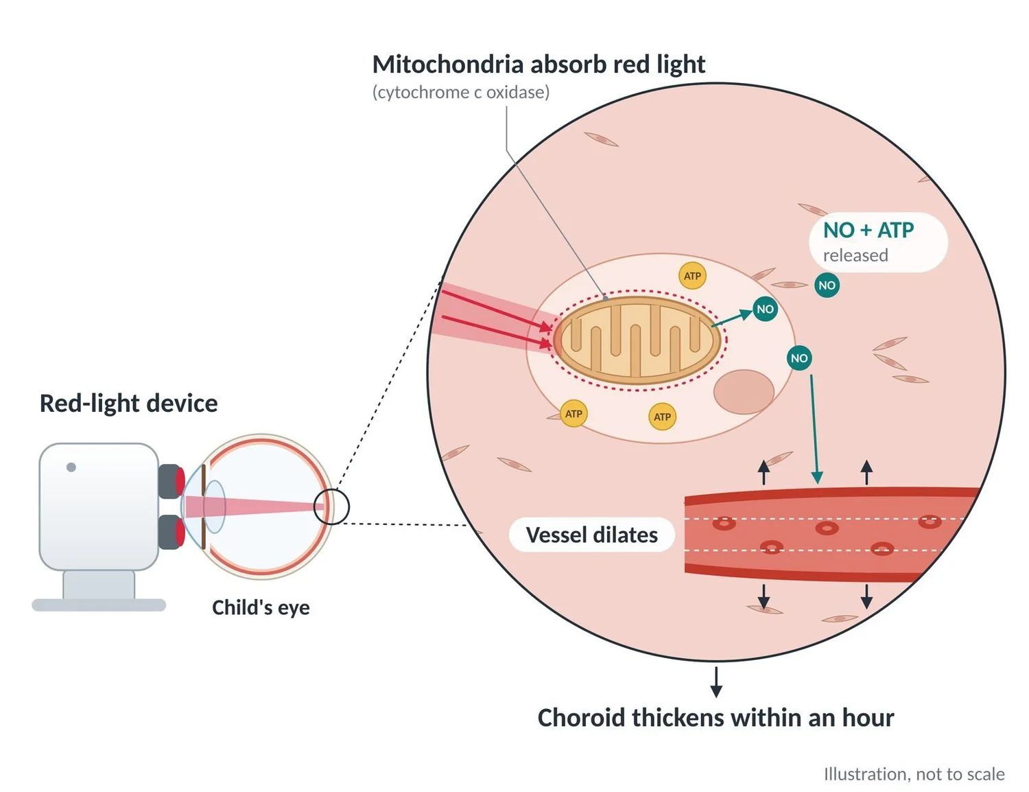 Red light is absorbed by mitochondria, releasing nitric oxide and dilating choroid vessels.