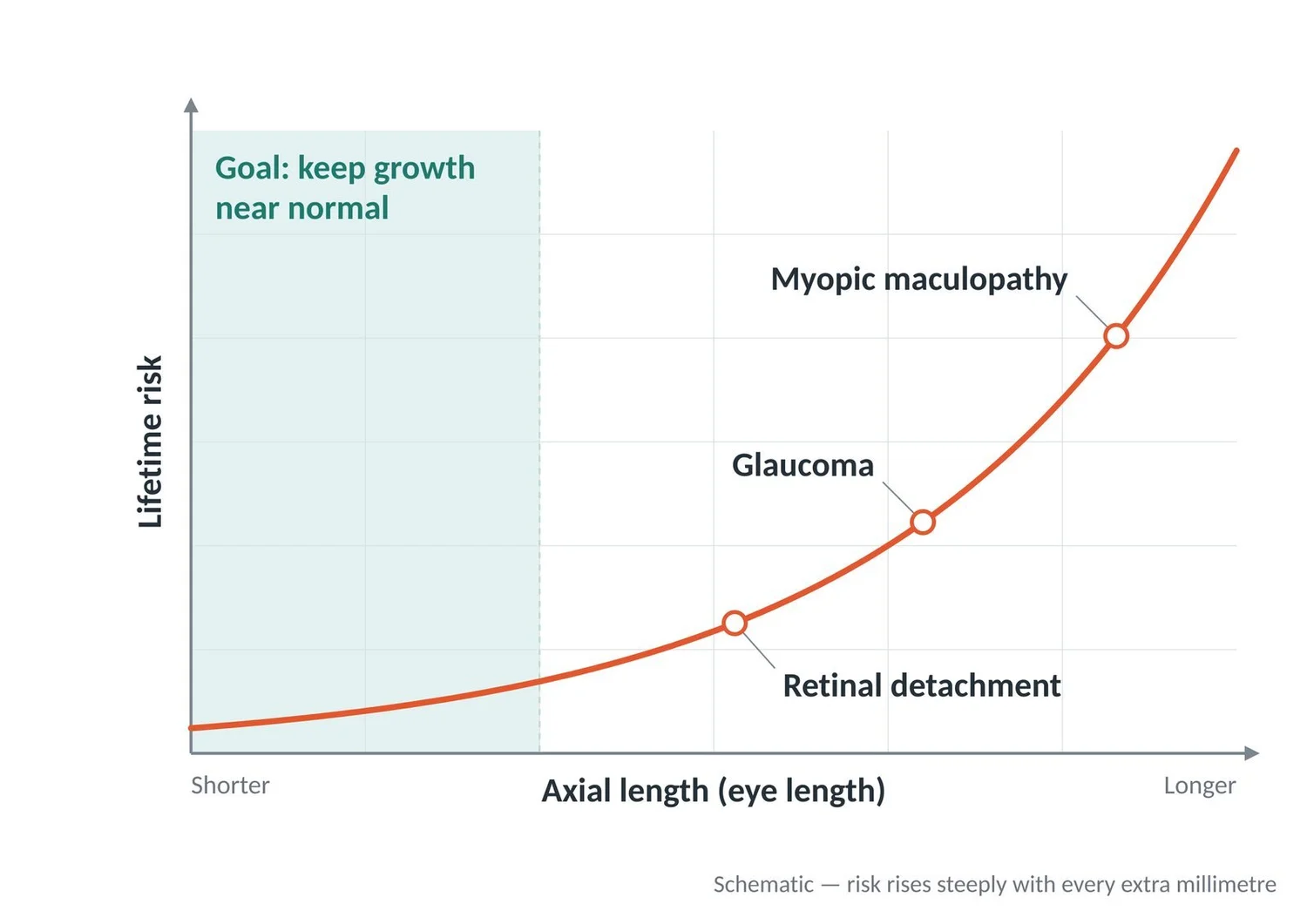 Chart: lifetime risk of retinal detachment, glaucoma and myopic maculopathy rises steeply as axial length increases.