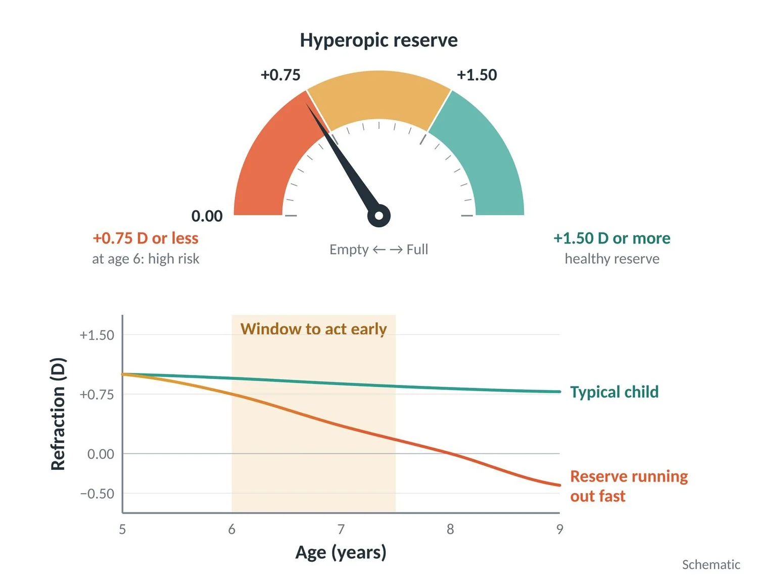Gauge and chart: a reserve of +0.75 D or less around age 6 signals high risk; the window to act is early.