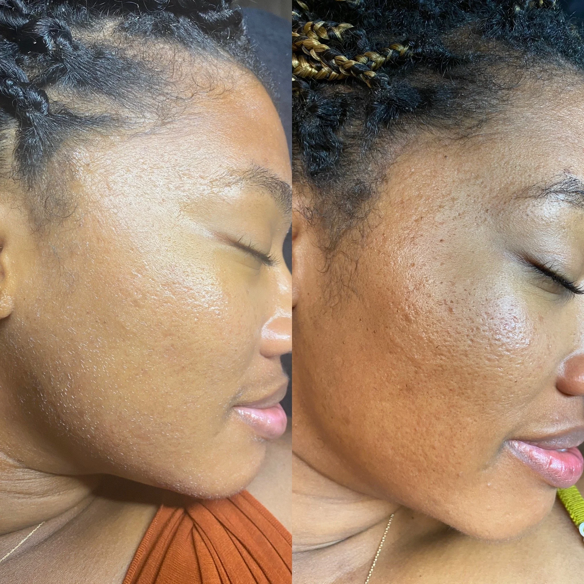 Before and After Transformation