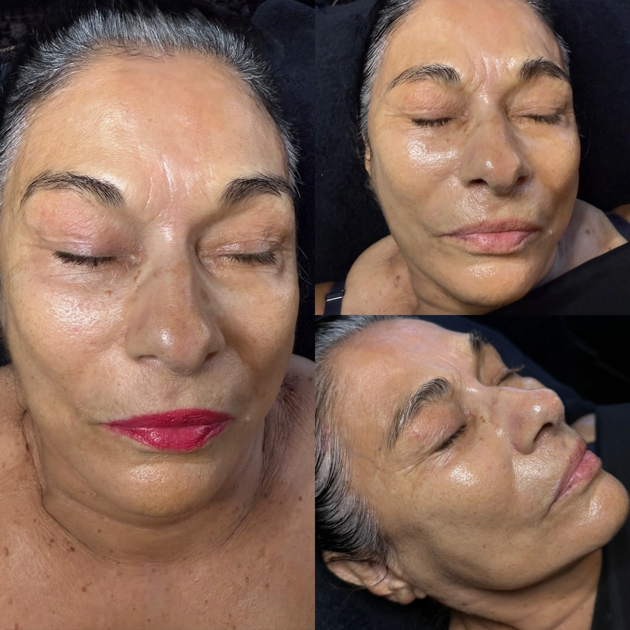 Beauty Treatment
