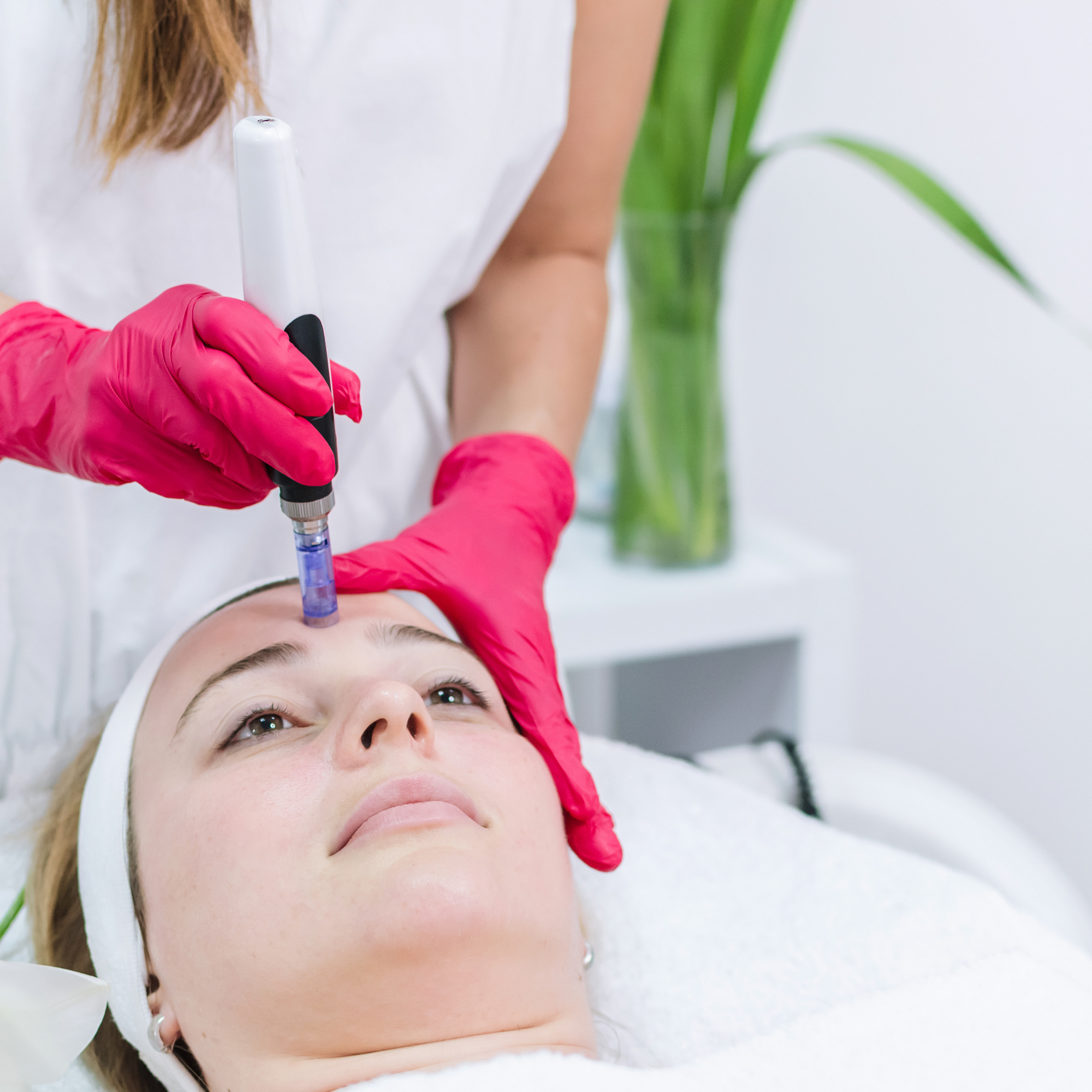 Microneedling