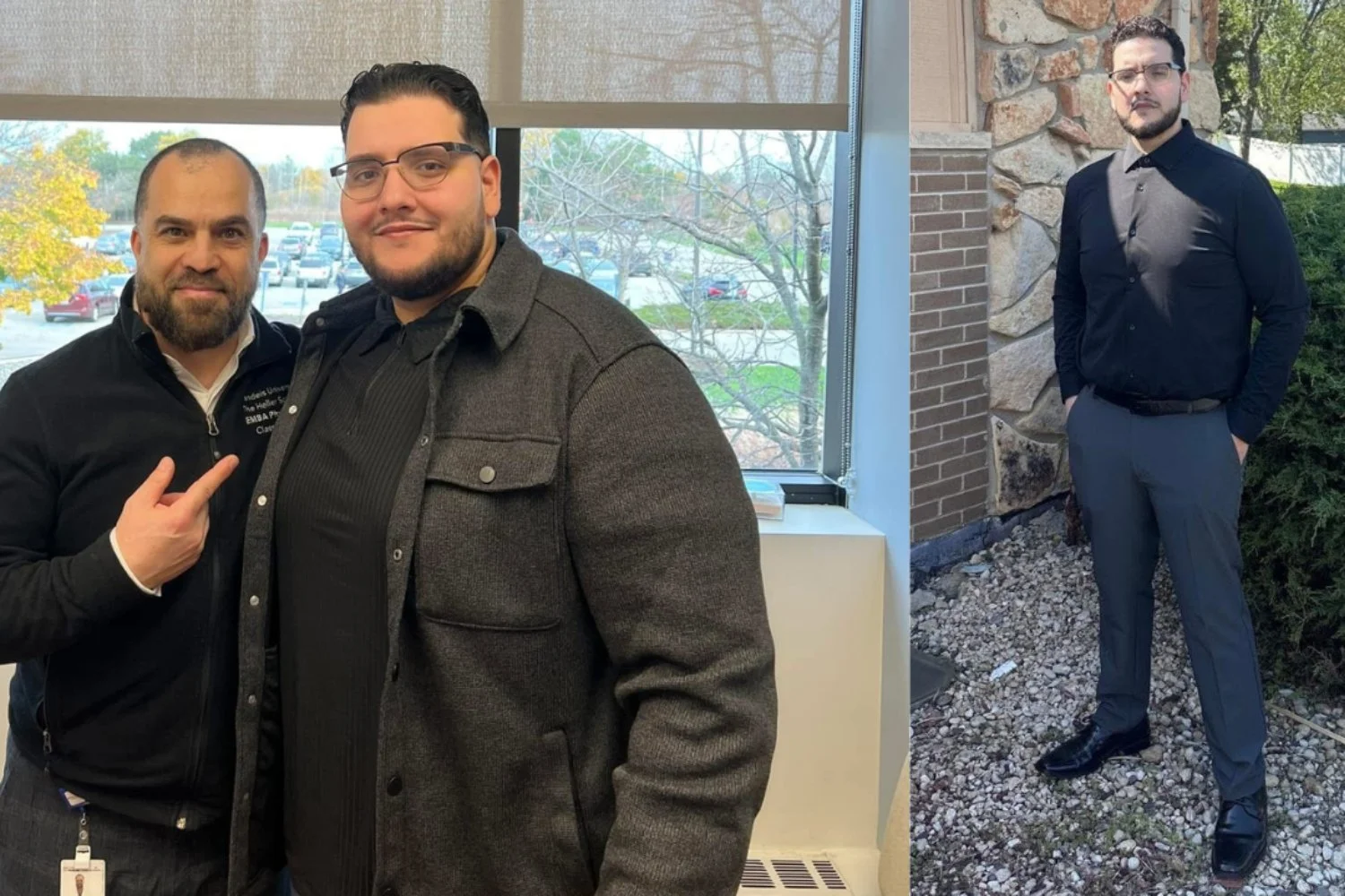 Patient Before and After Bariatric Surgery