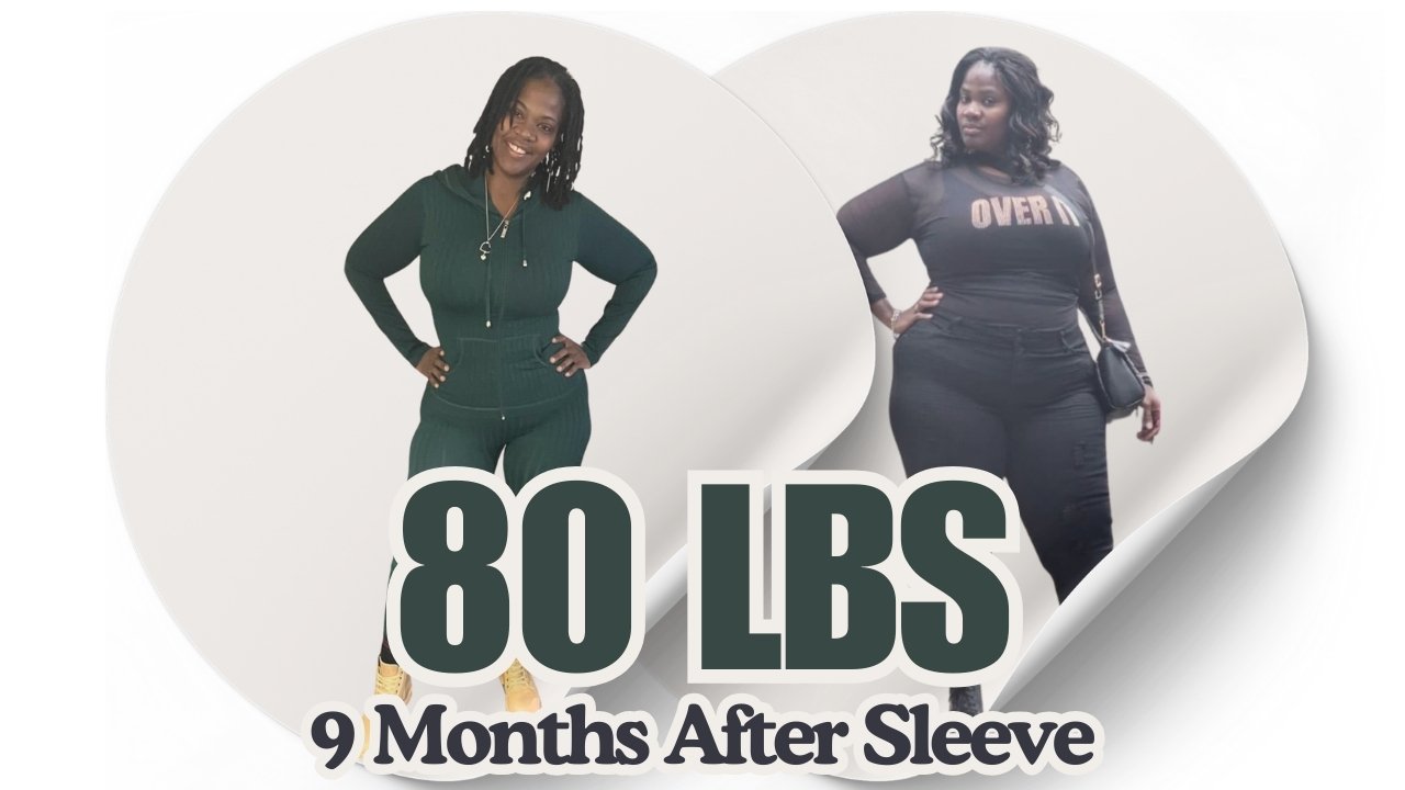 Weight Loss Surgery Results