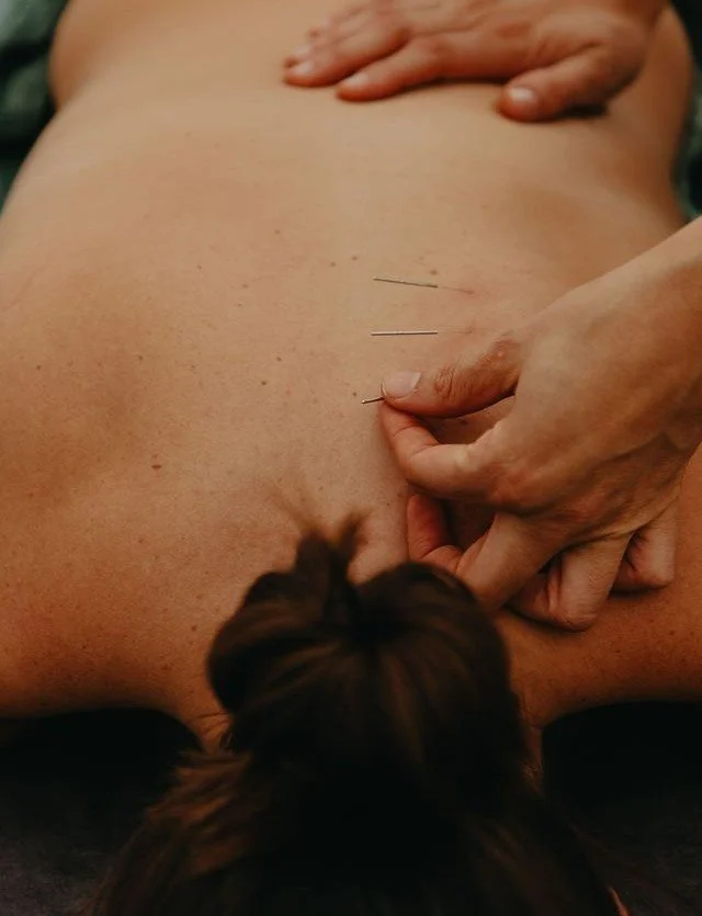 Who May Benefit From Dry Needling