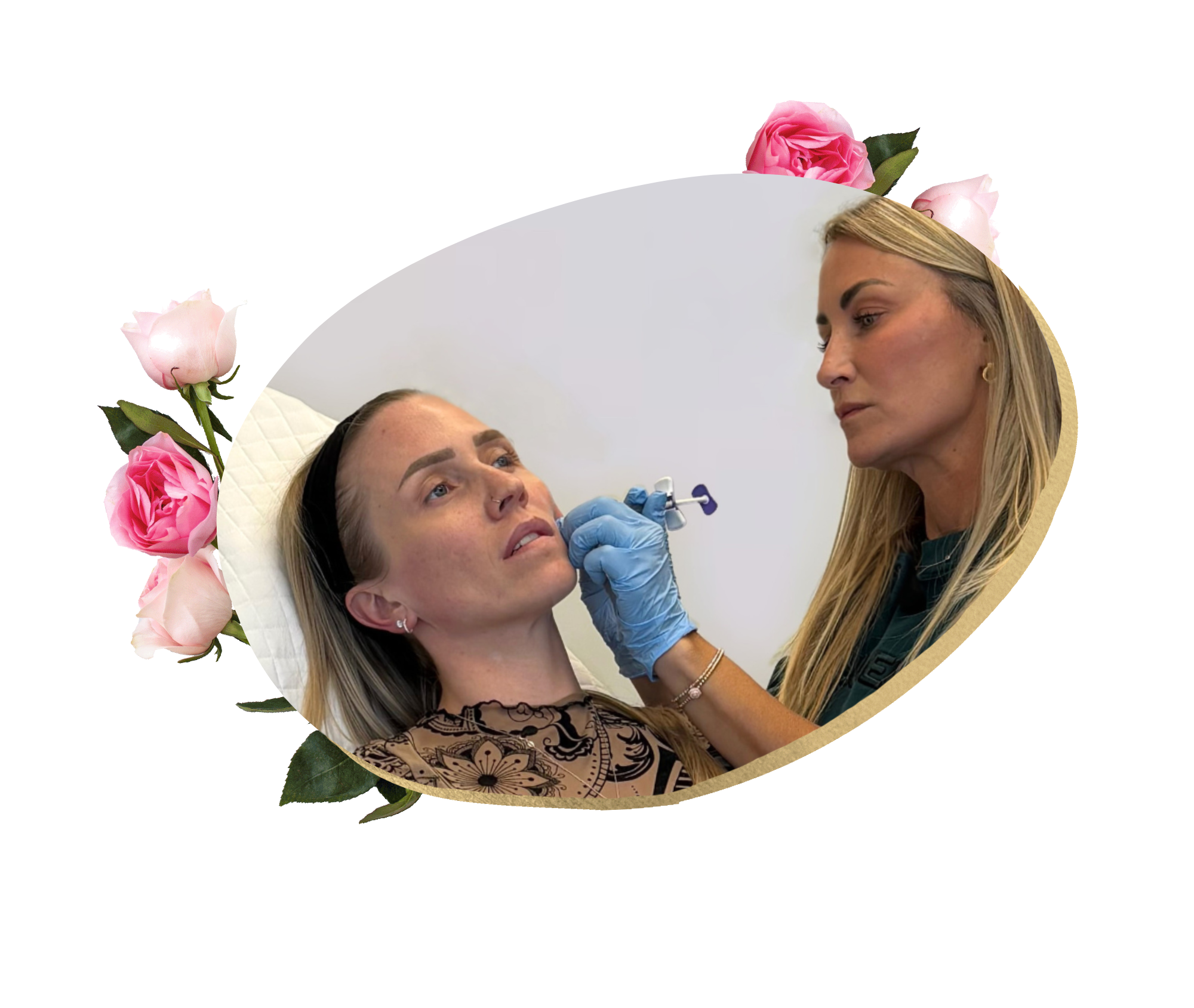 HArmonyCa™ Hybrid Injectable Treatments at PHI Medical Aesthetics