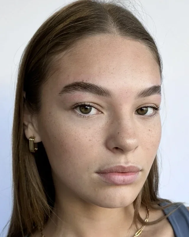 Brow treatment