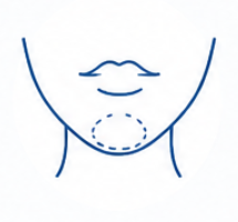 Chin Dimpling
