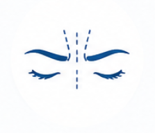 Glabella