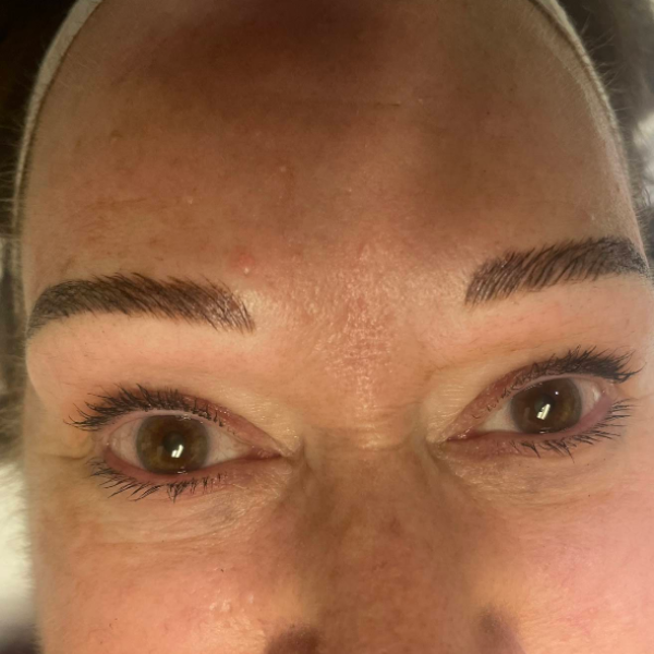 Eyebrow Enhancement