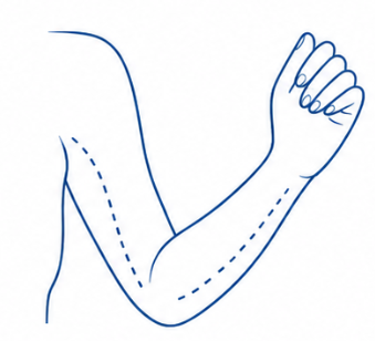 Arms