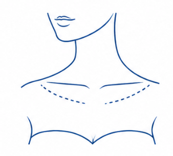 Chest