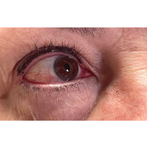 Volume Lash Extensions