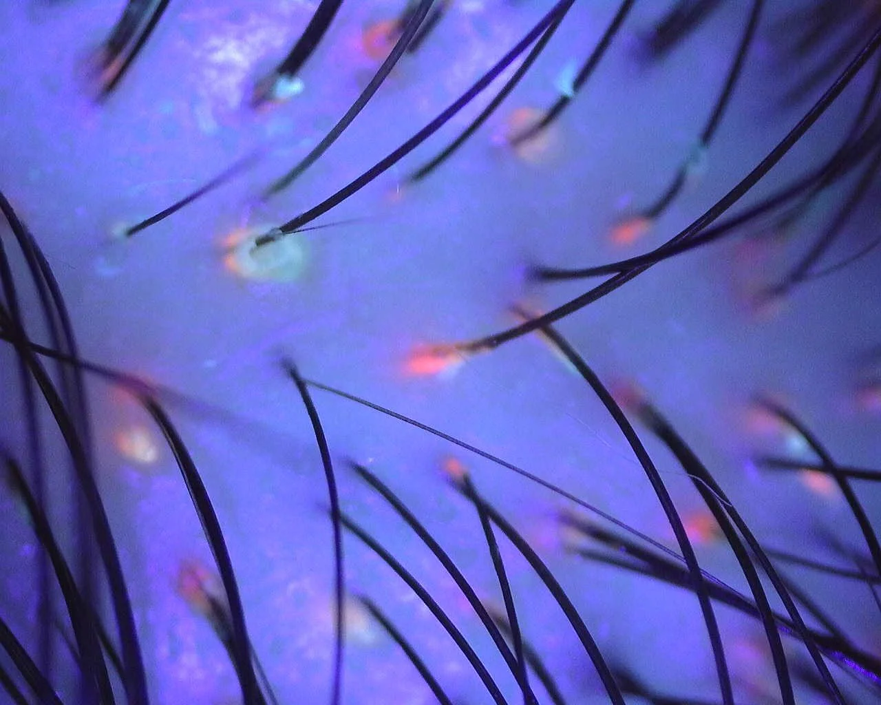 Magnified trichoscope view of scalp skin and emerging hairs.