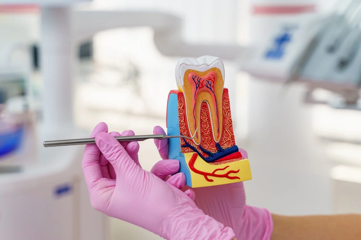 Endodoncia en CDMX