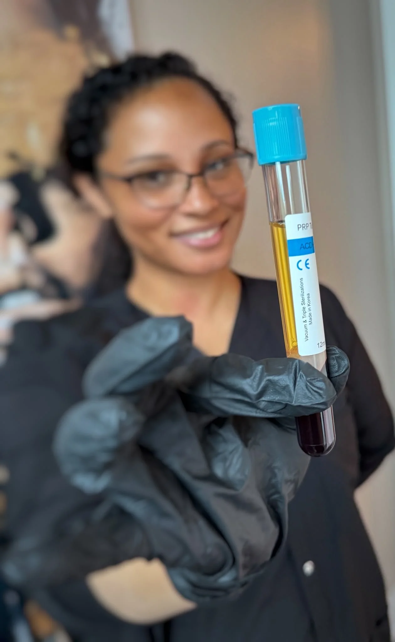 PRP tube for platelet rich plasma microneedling protocol