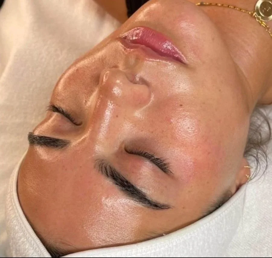Custom clinical facial treatment result in Brampton