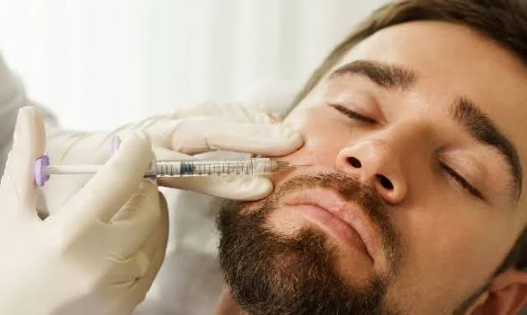 Dermal filler injection at cheek