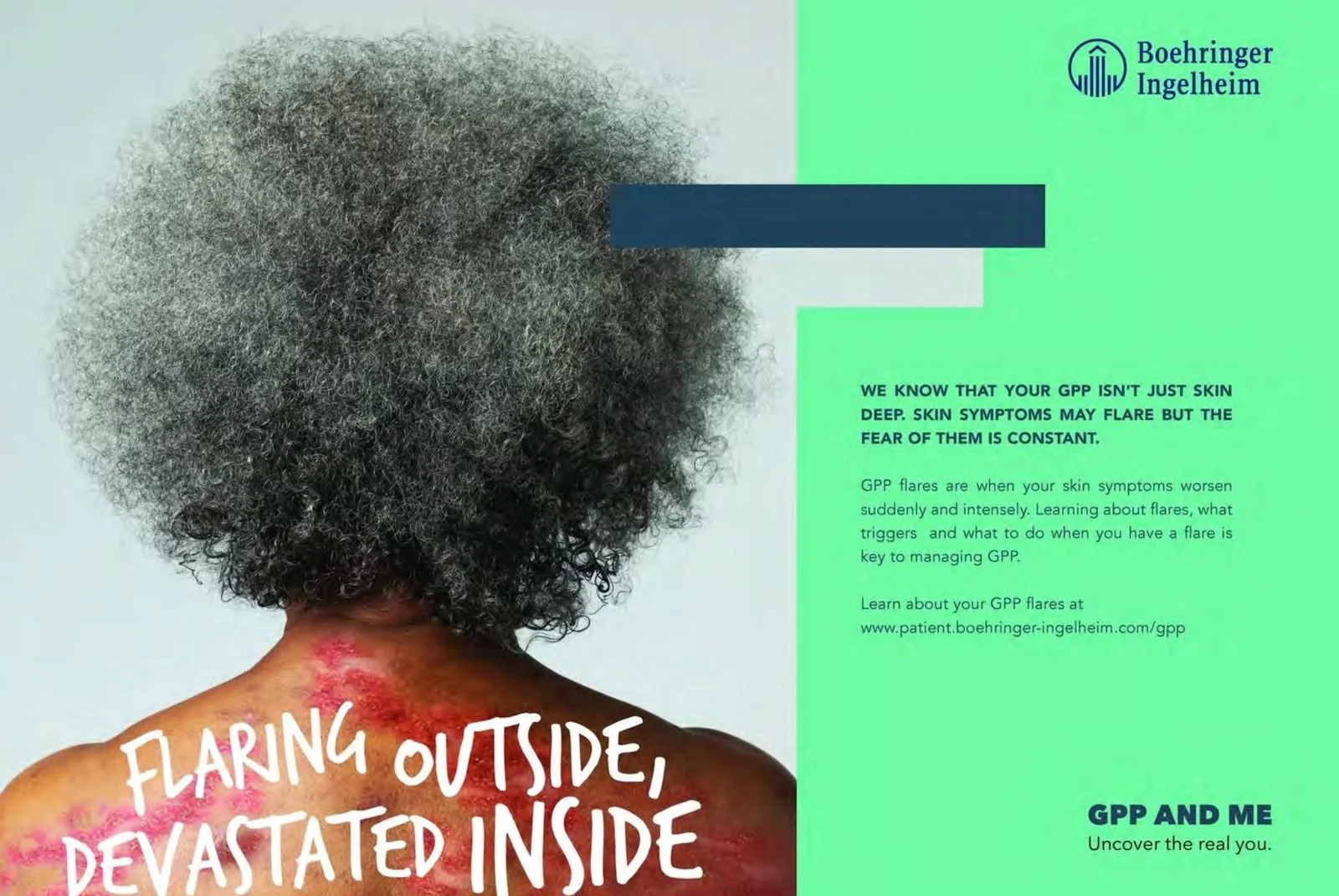 GPP & Me ad: Flaring outside, devastated inside, written on a woman's back
