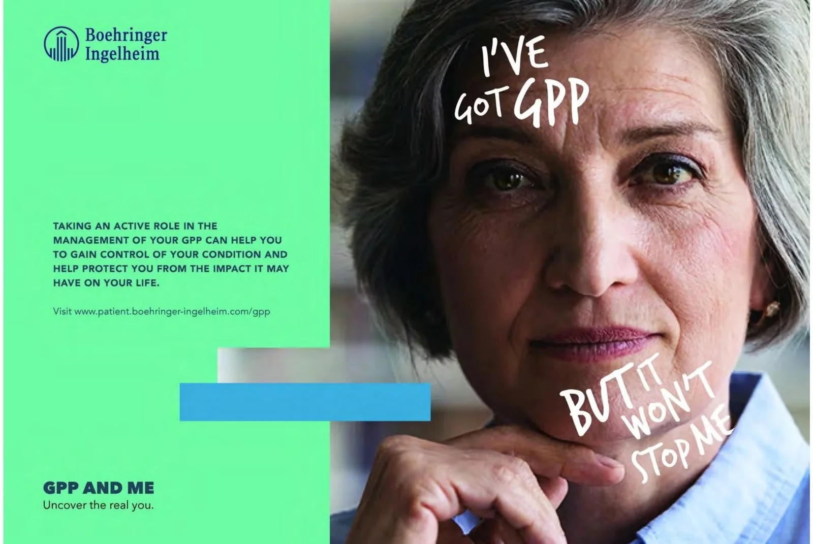 GPP & Me ad: I've got GPP but it won't stop me, written on a woman's face