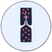 Illustration: a healthy vein with working valves