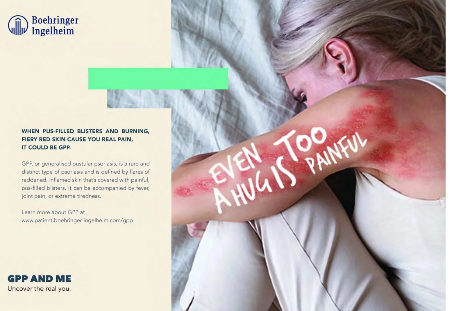 GPP & Me ad: Even a hug is too painful, written on a woman's inflamed arm