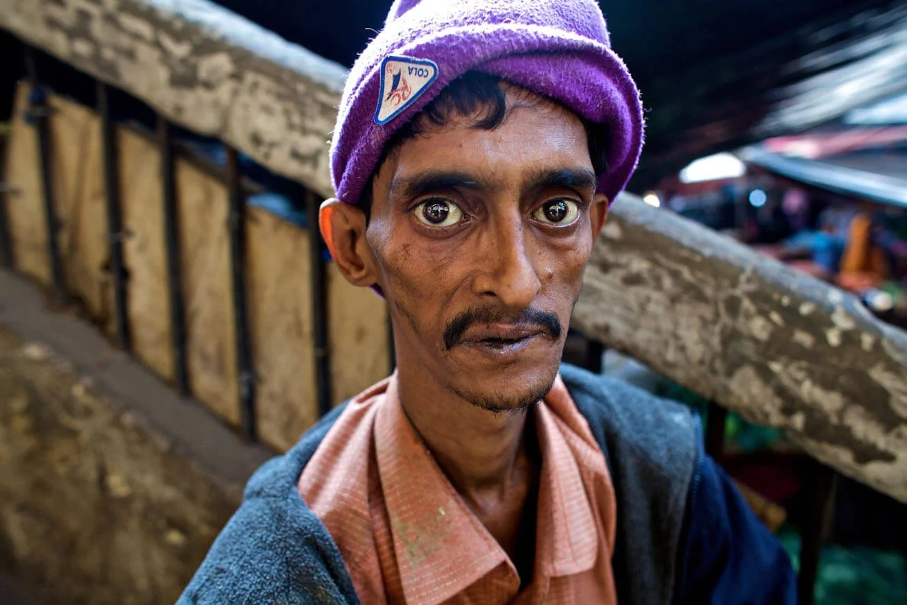 Drug addict in Old Dhaka, NGO photography for USAID Bangladesh