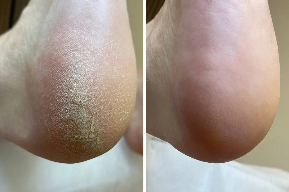 After Russian pedicure — smooth heels Mars Nails