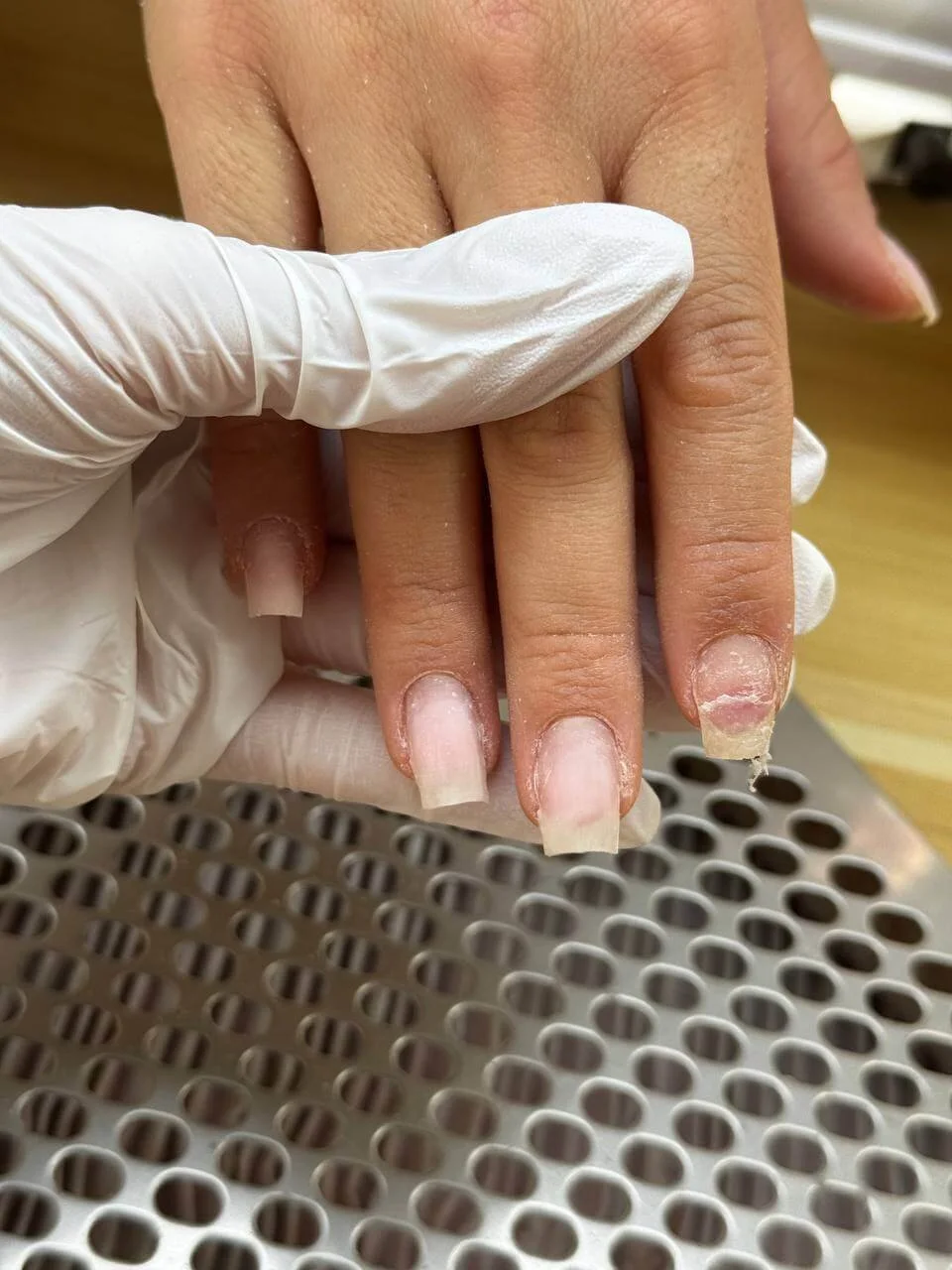 Natural nails with previous product lifting and overfiled sidewalls before nail repair