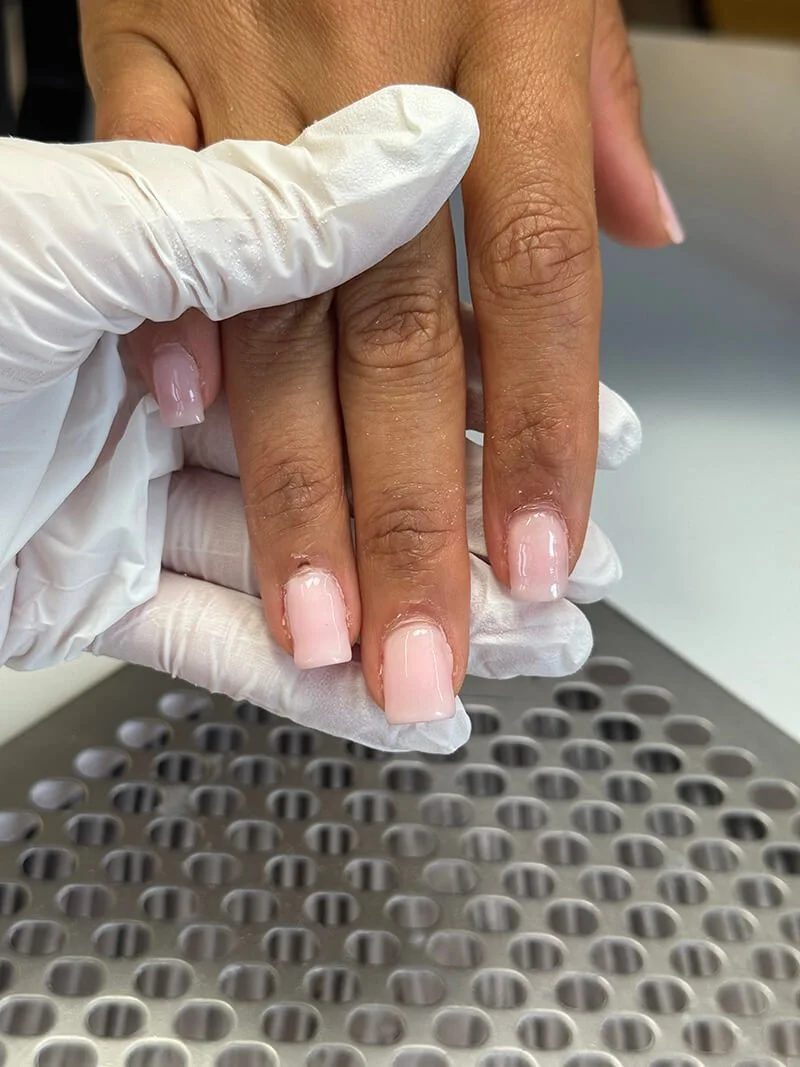 Nails after old acrylic removal before restructuring