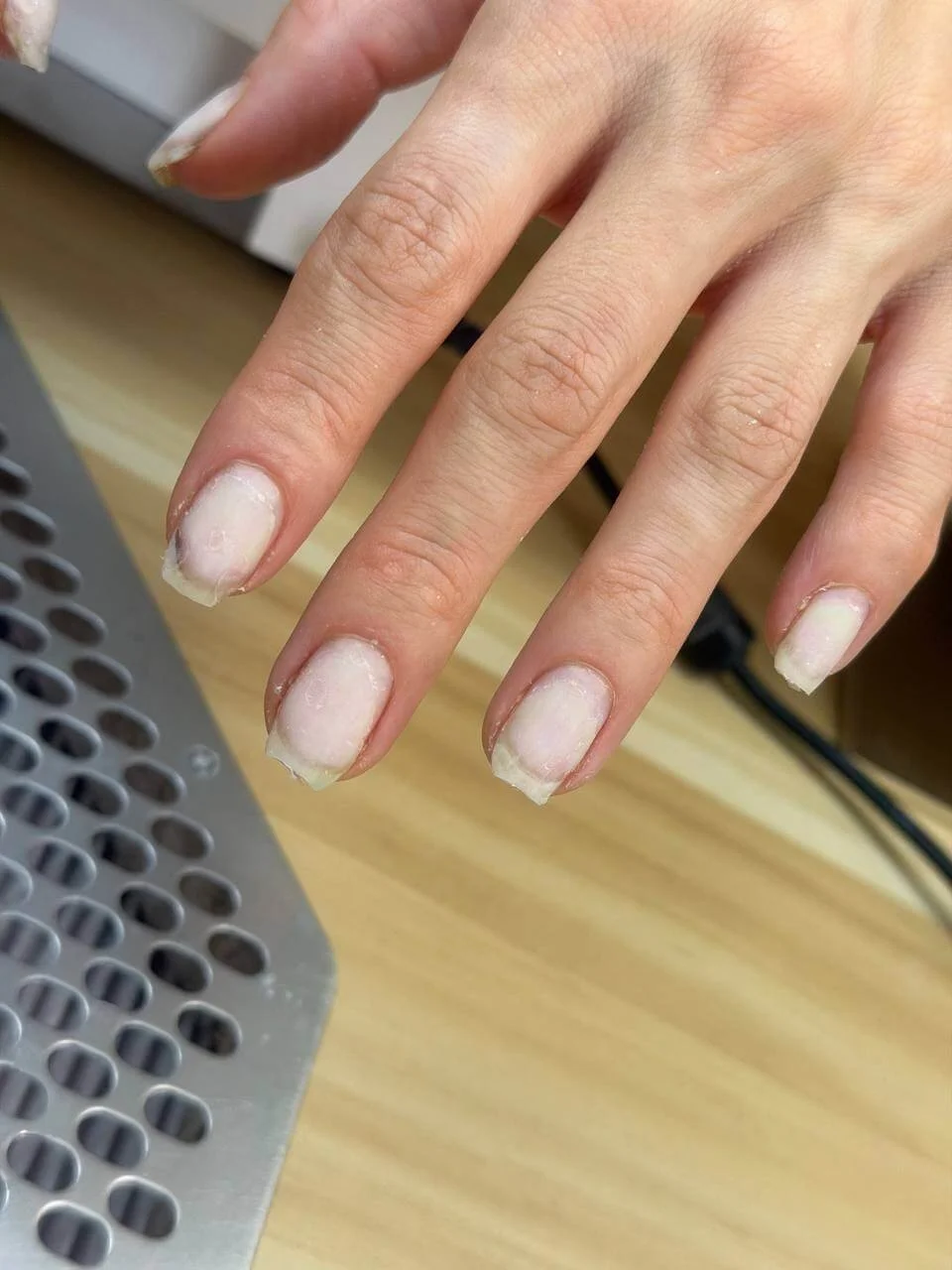 Natural nails with thin free edges before localized hard gel reinforcement