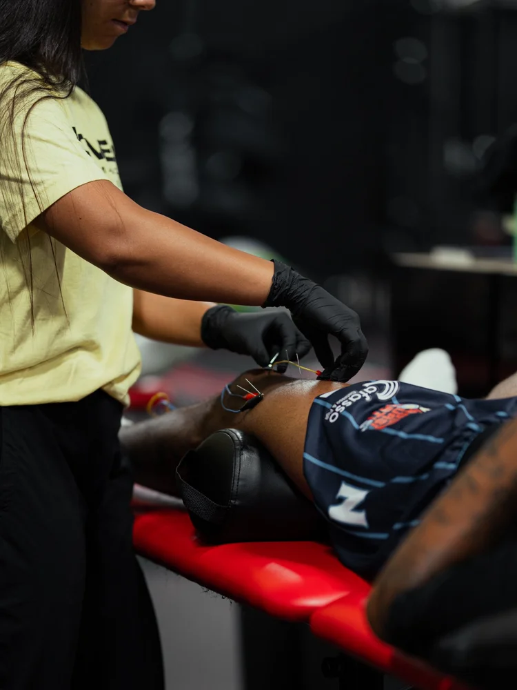Dry needling treatment on an athlete