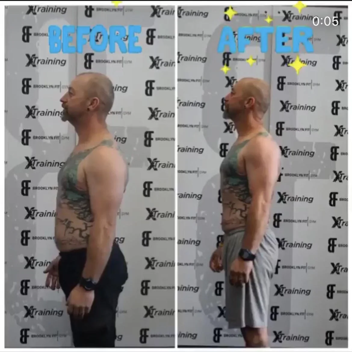 Posture correction — side profile