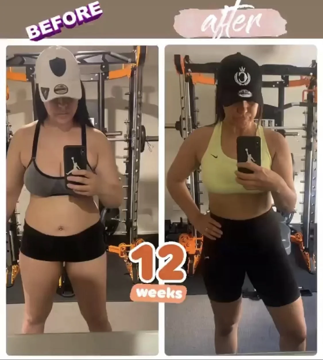 Body recomposition – front view