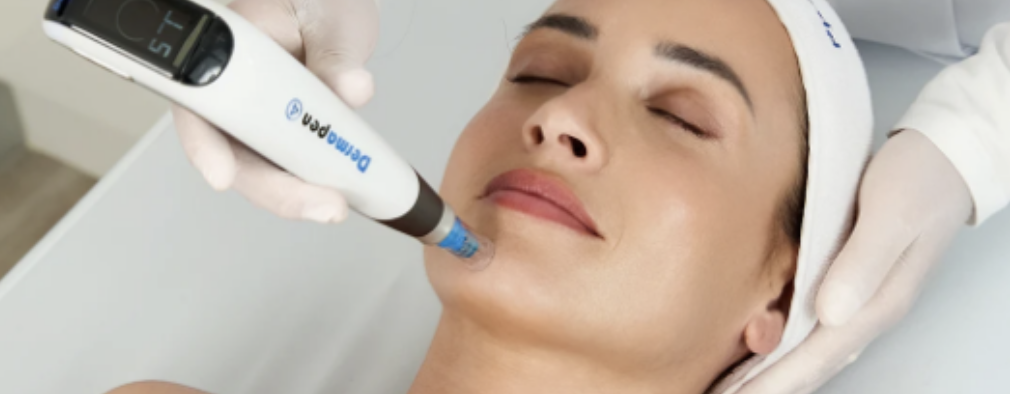 Dermapen 4 microneedling treatment close-up