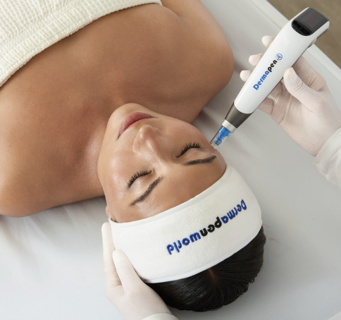 Customized Dermapen 4 facial microneedling treatment