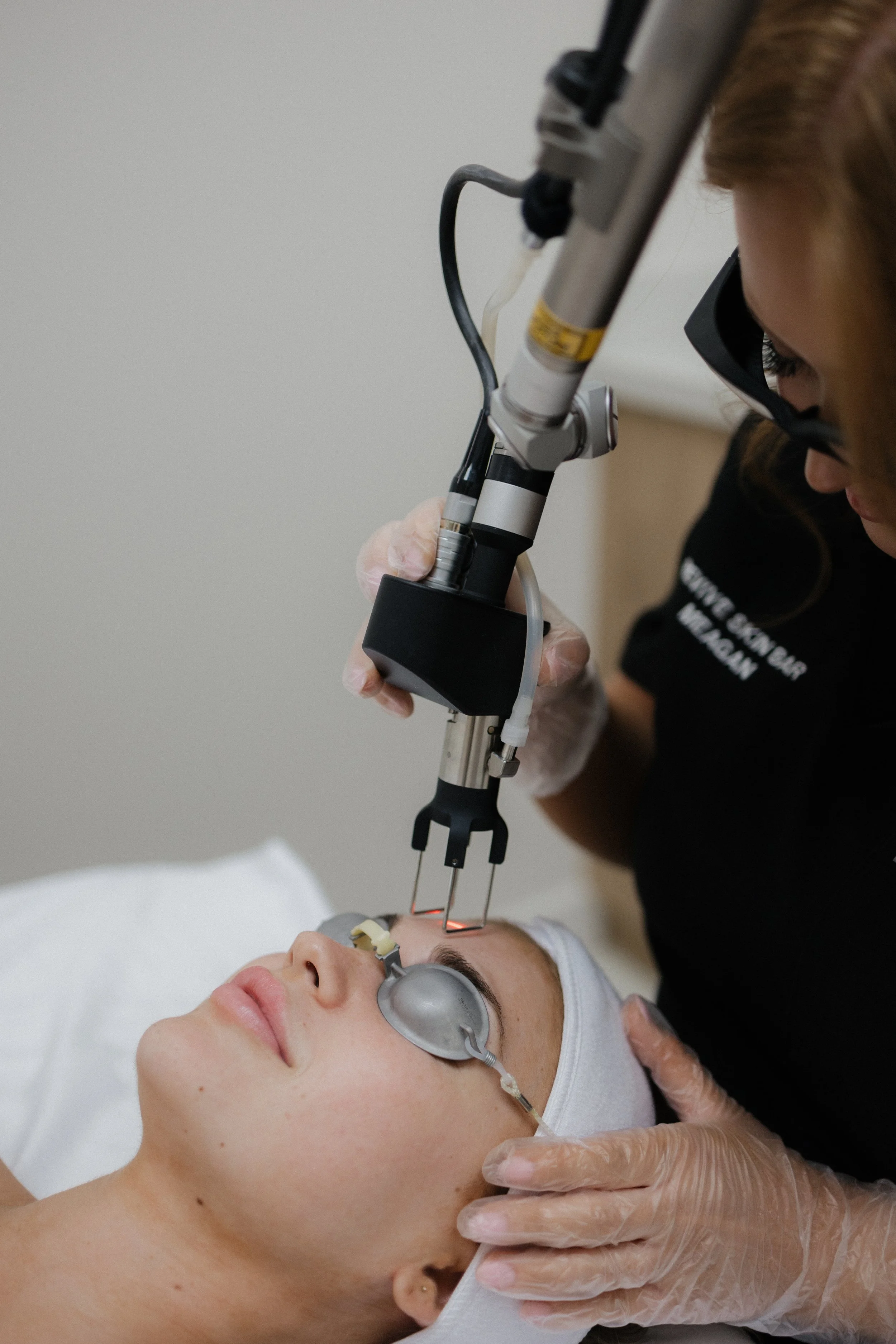 Laser hair reduction treatment