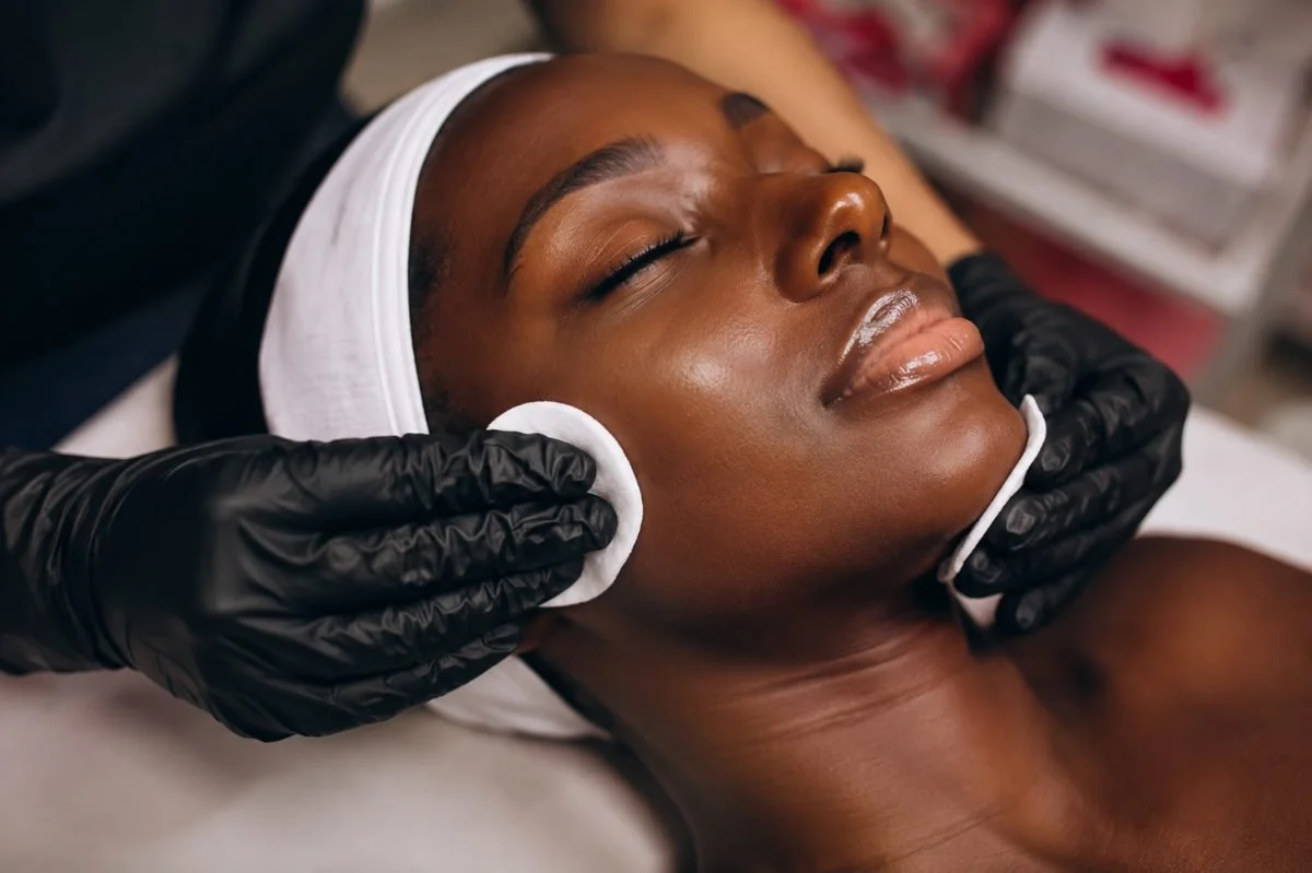 Chemical peel treatment