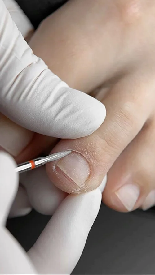 Nail artist working carefully around a toenail with a fine drill bit