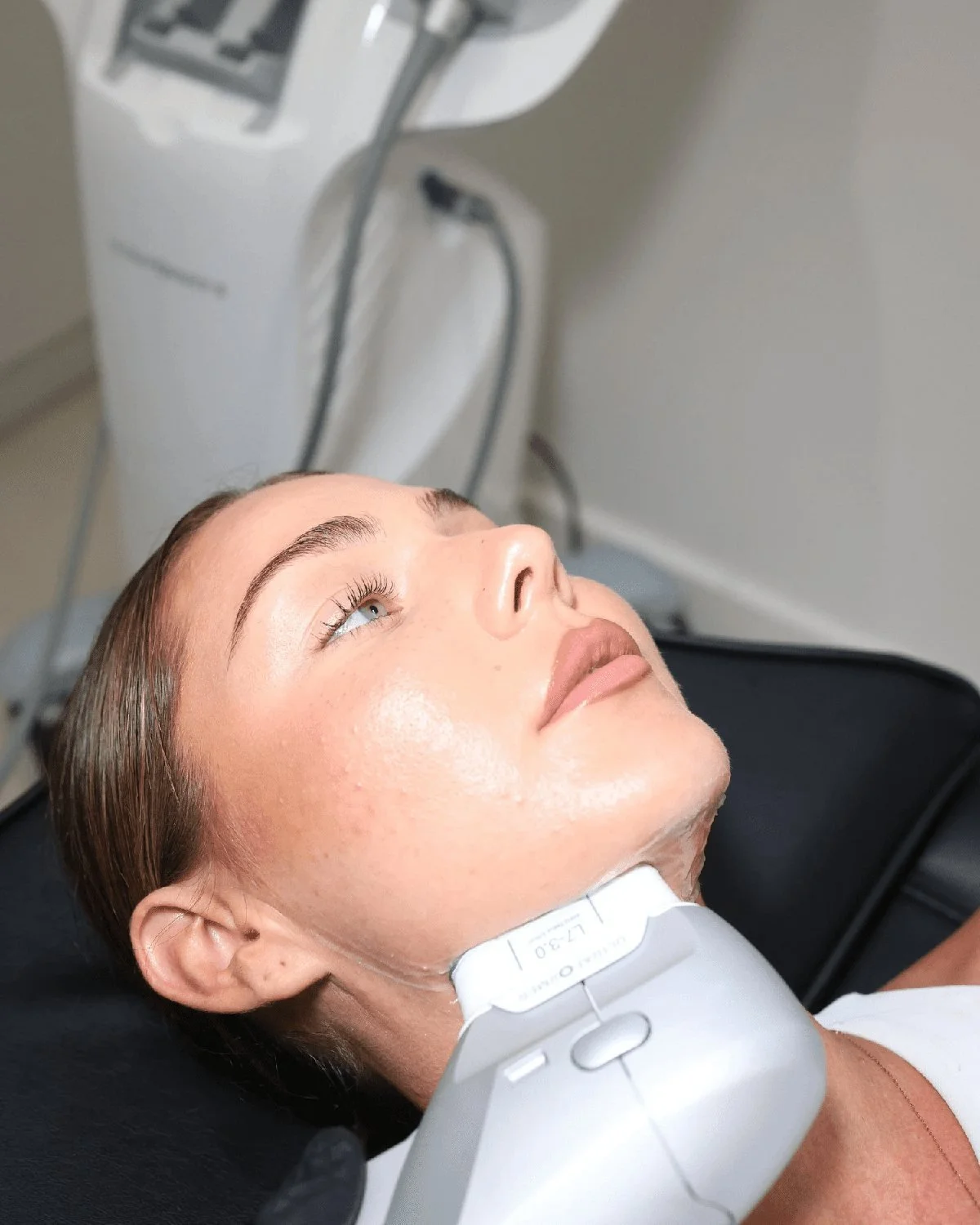 Ultraformer HIFU handpiece treating the jawline at Sculptd
