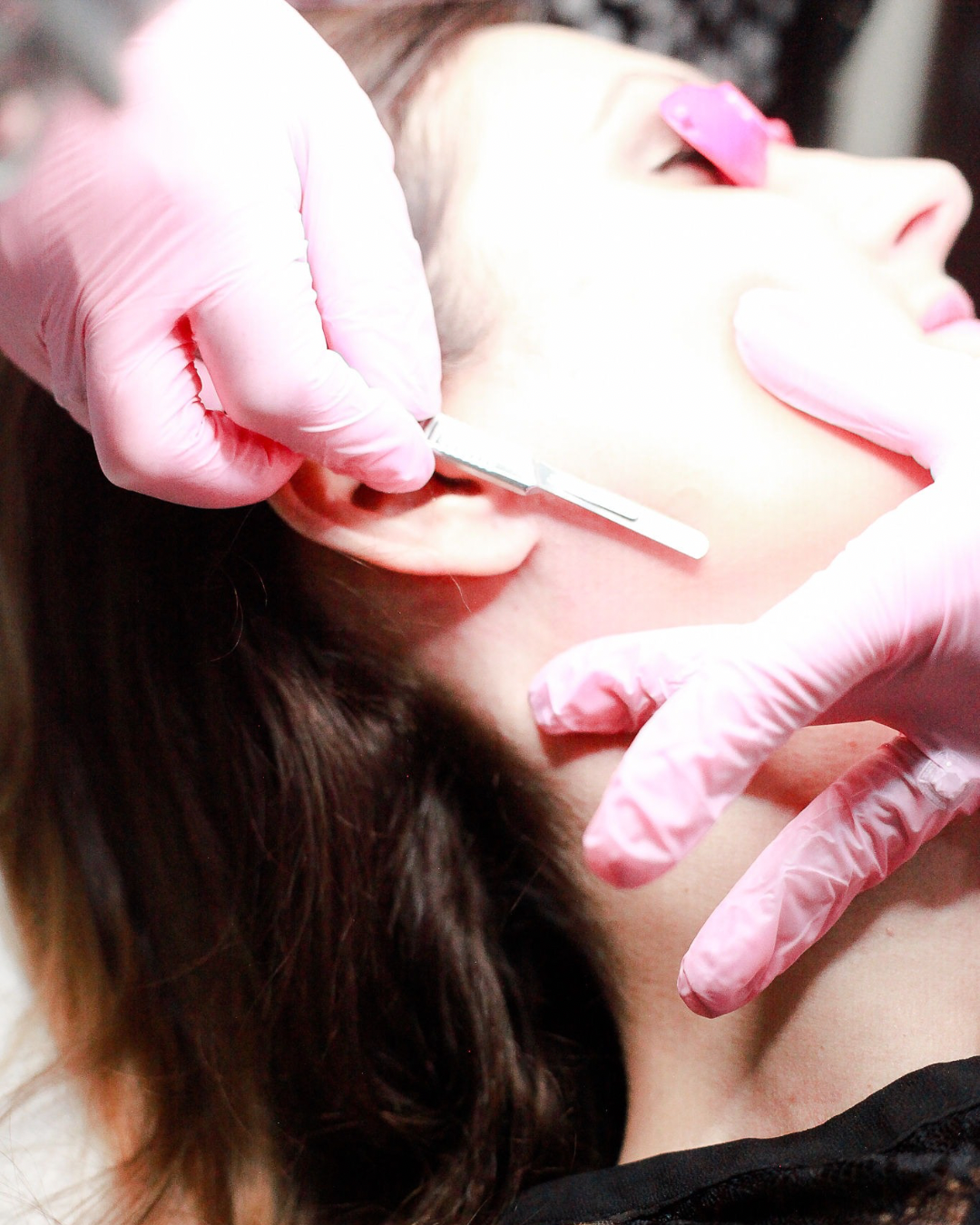 Dermaplaning Facial at Zinovations