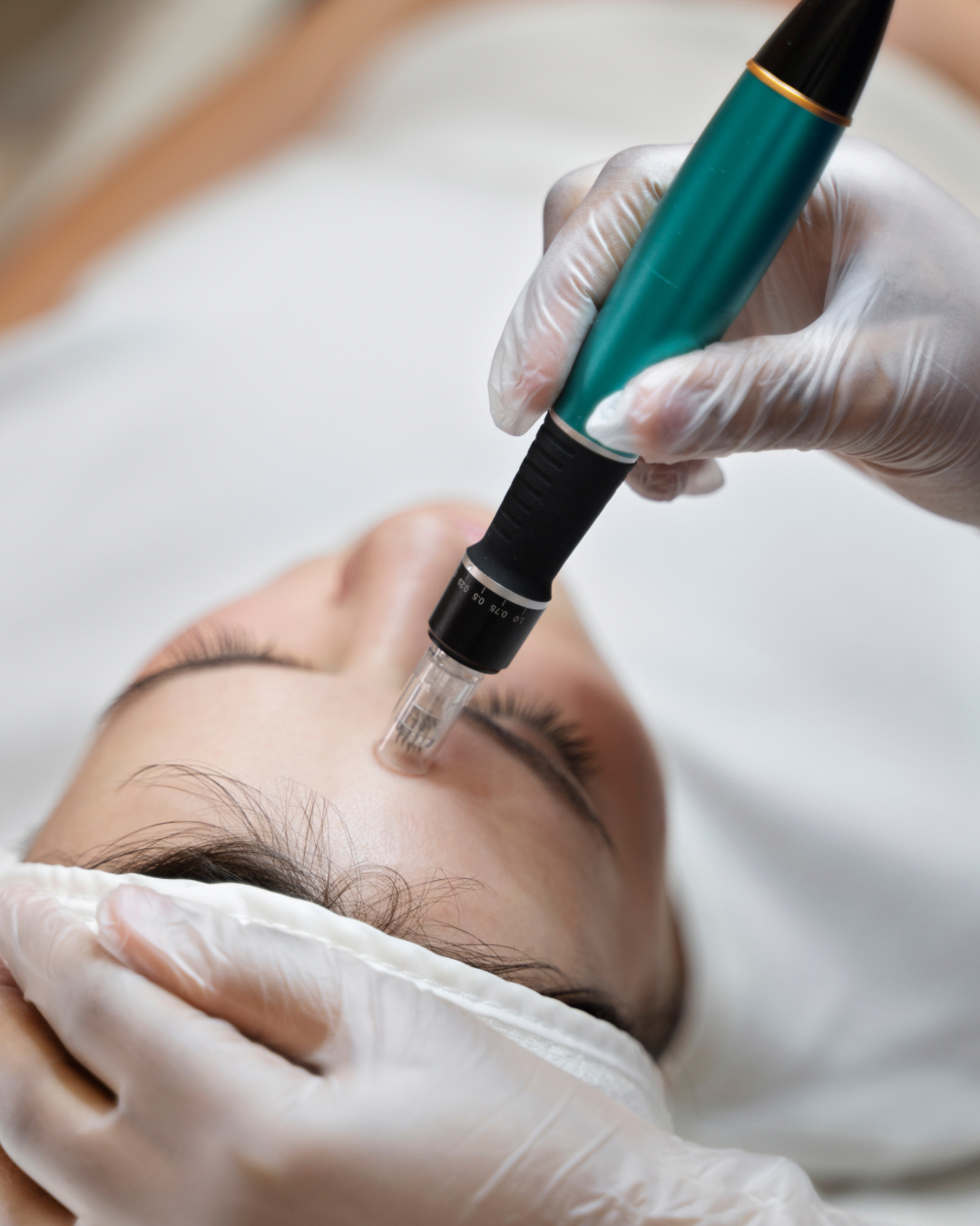 The Cleopatra Technique Treatment