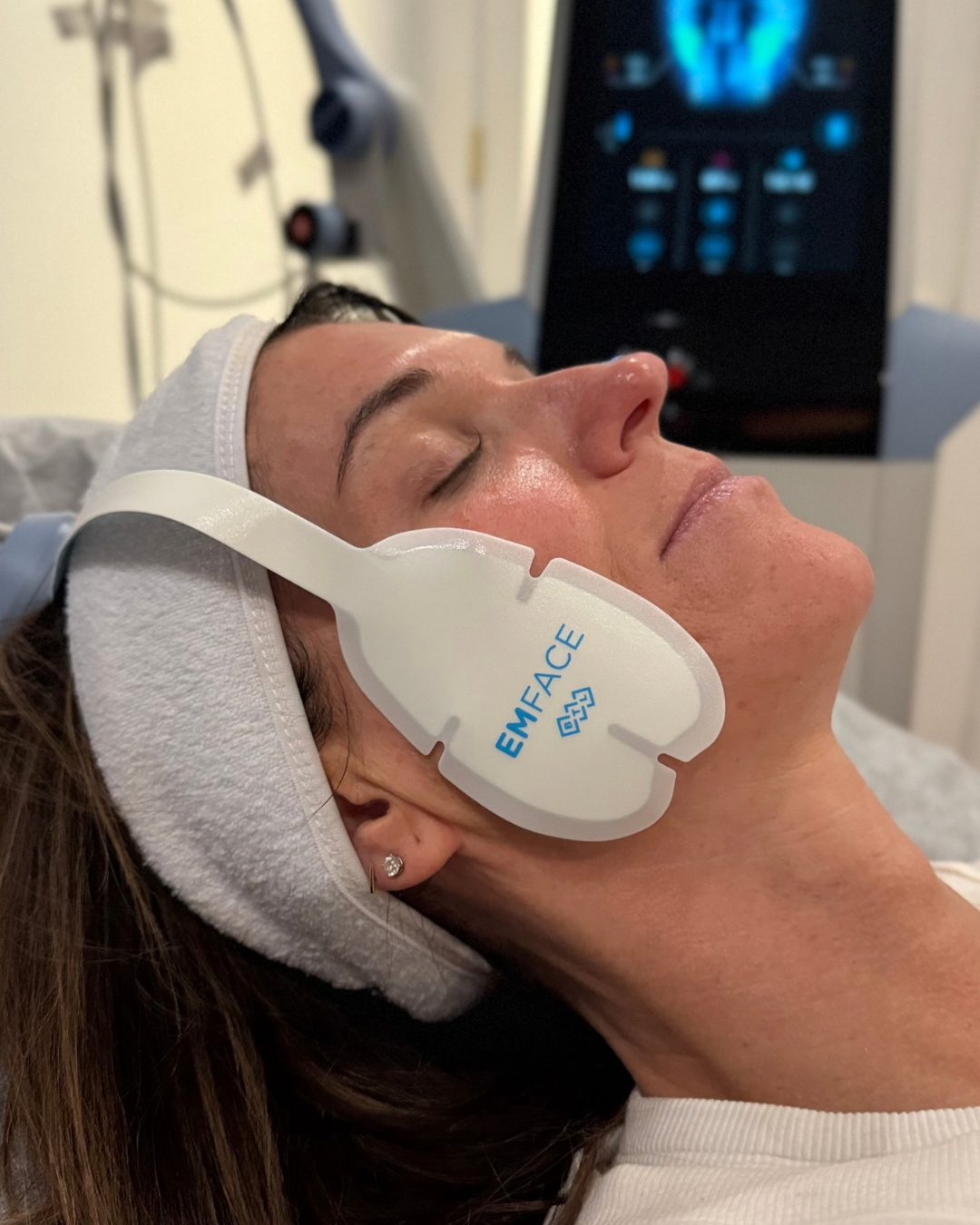 EMFACE for TMJ Treatment