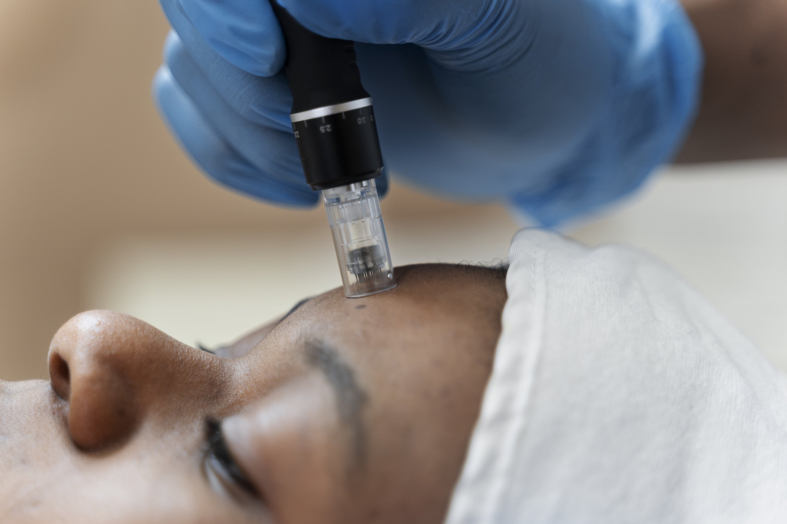 Precision Treatment Session
