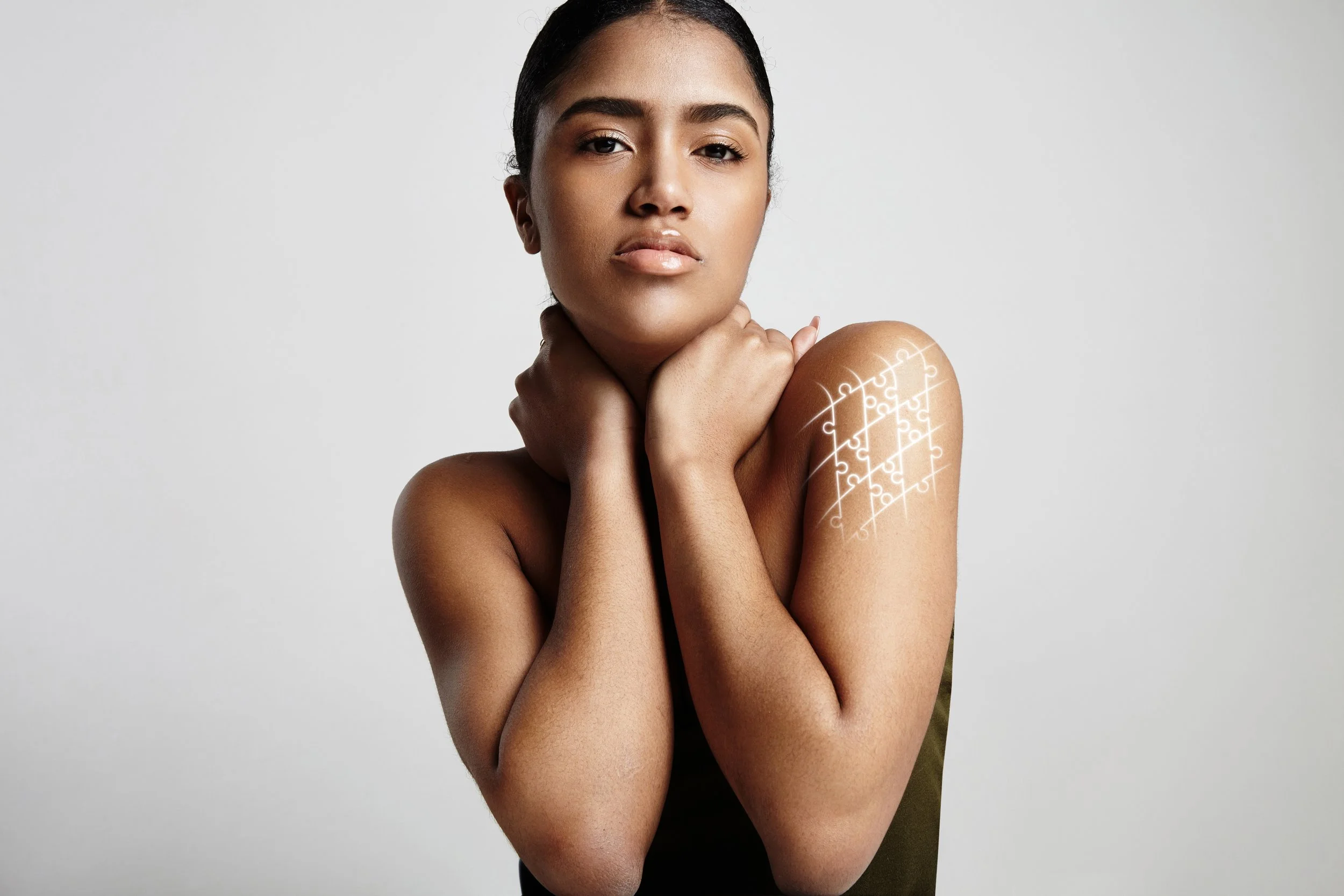 Fotona FracTAT Tattoo Removal