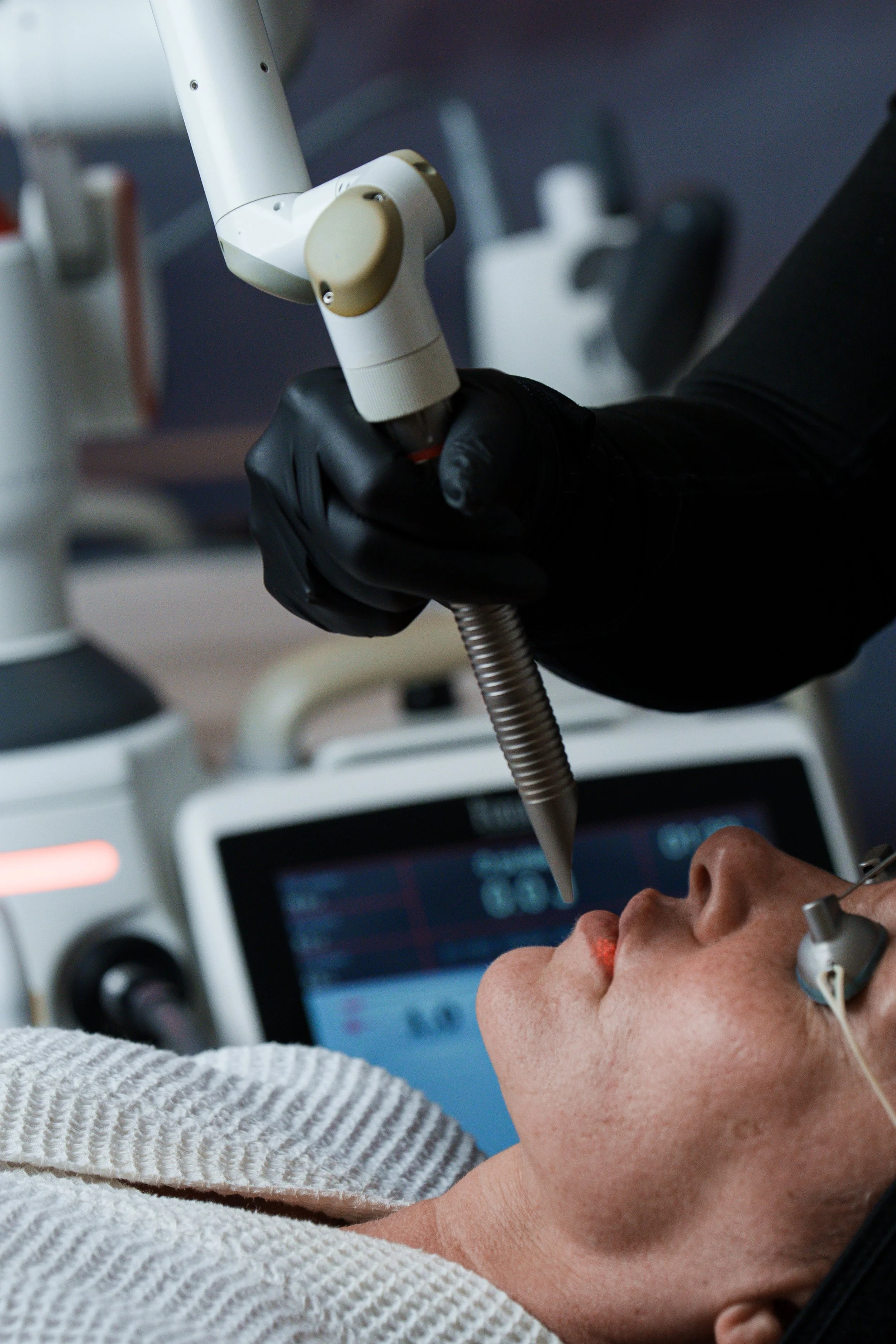 Laser treatment