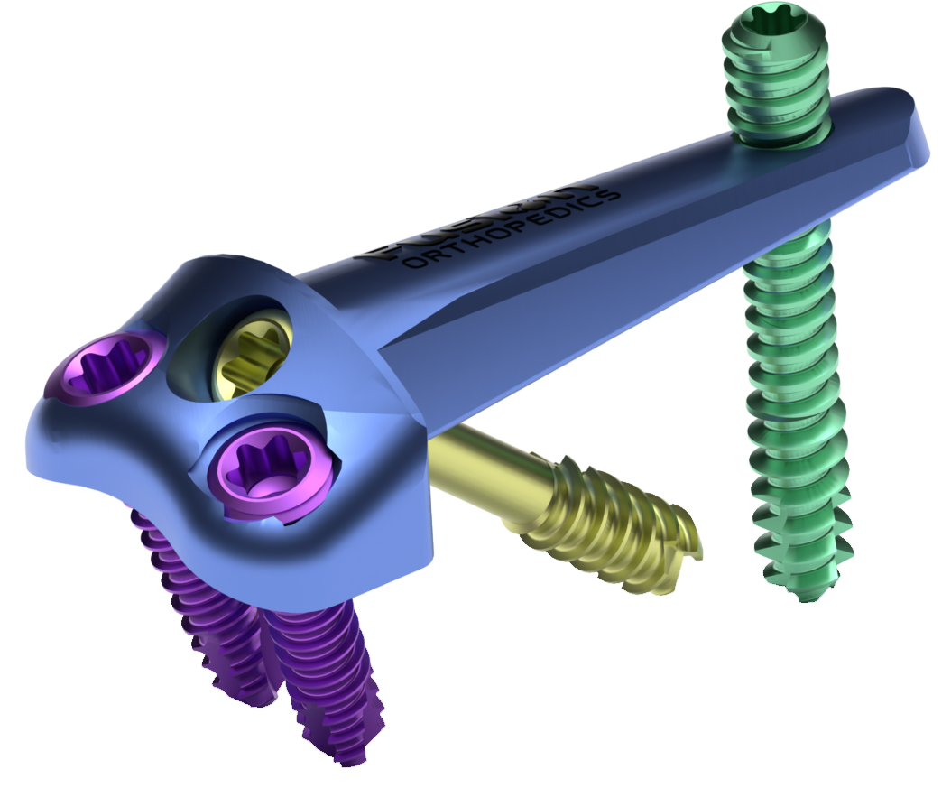 Fusion Orthopedics MiniLock product image