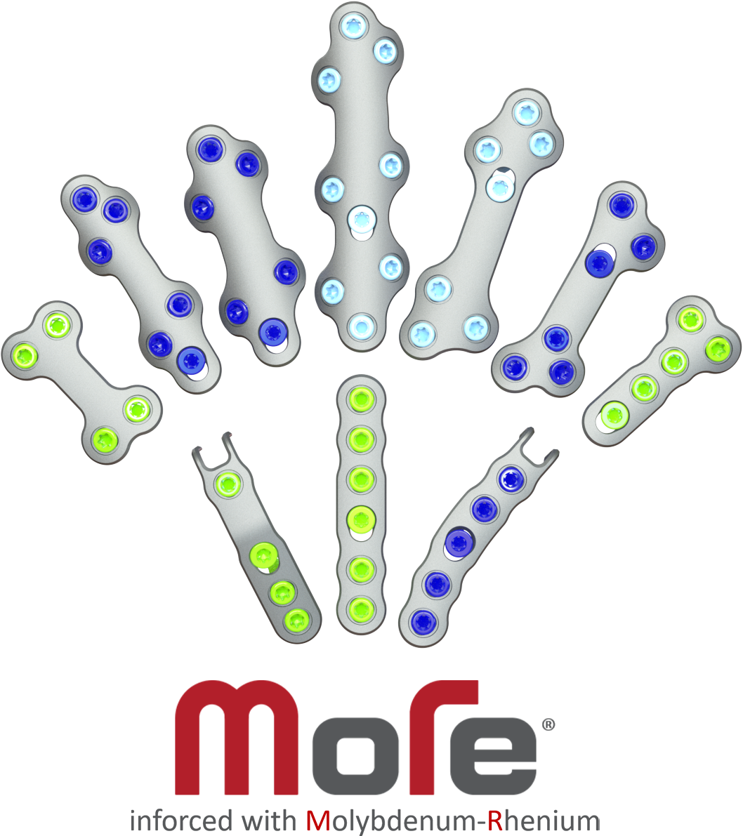 MiRus MoRe Atlas Foot and Ankle System