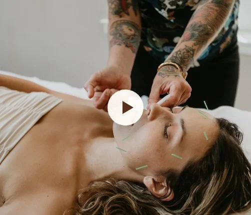 Microneedling and Facial Acupuncture Treatment